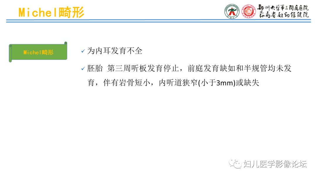 影像PPT - 【PPT】感音神经性耳聋影像诊断-38
