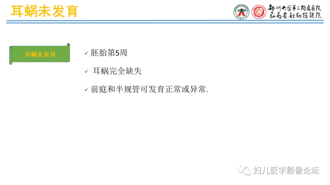 影像PPT - 【PPT】感音神经性耳聋影像诊断-42