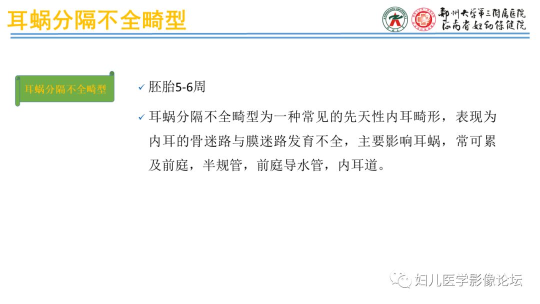 影像PPT - 【PPT】感音神经性耳聋影像诊断-47