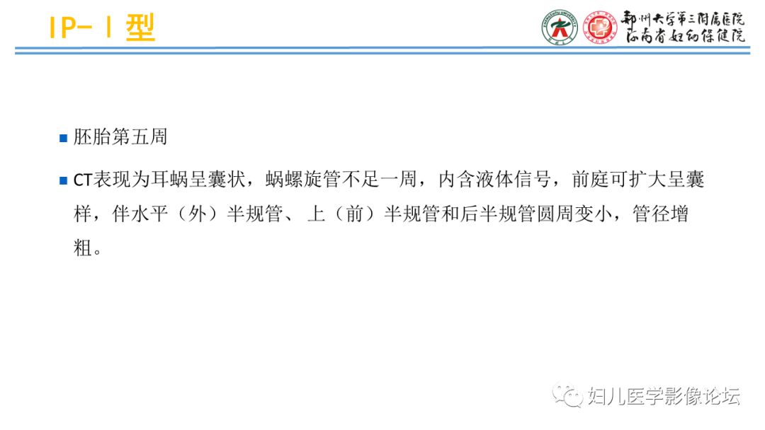 影像PPT - 【PPT】感音神经性耳聋影像诊断-50