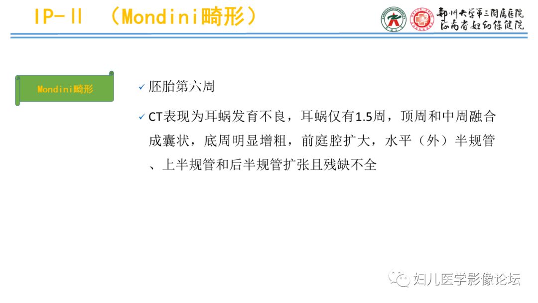 影像PPT - 【PPT】感音神经性耳聋影像诊断-52