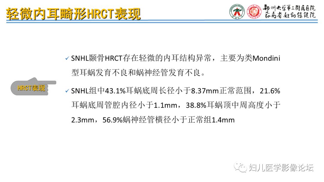 影像PPT - 【PPT】感音神经性耳聋影像诊断-83