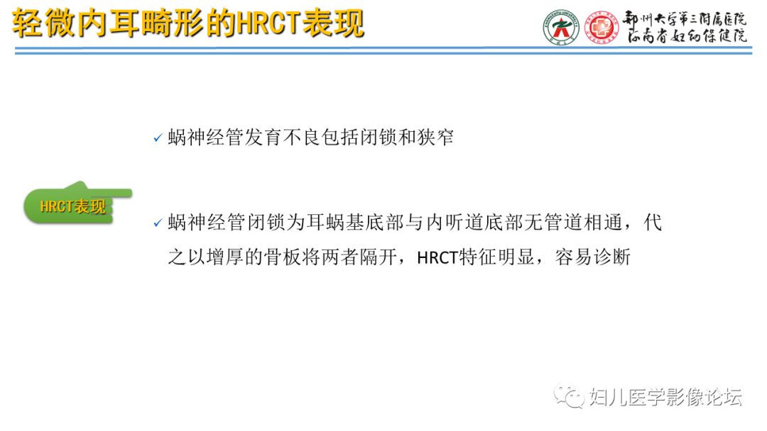 影像PPT - 【PPT】感音神经性耳聋影像诊断-87