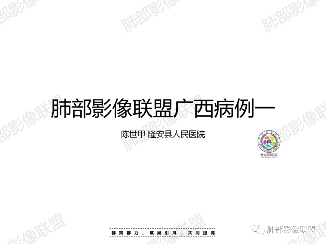 影像PPT - 【病例】胸腔内占位—异位肝1例CT影像-1 影像PPT - 【病例】胸腔内占位—异位肝1例CT影像-1