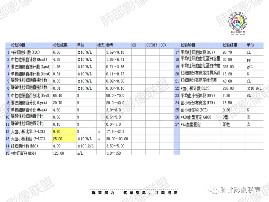 影像PPT - 【病例】胸腔内占位—异位肝1例CT影像-3 影像PPT - 【病例】胸腔内占位—异位肝1例CT影像-3