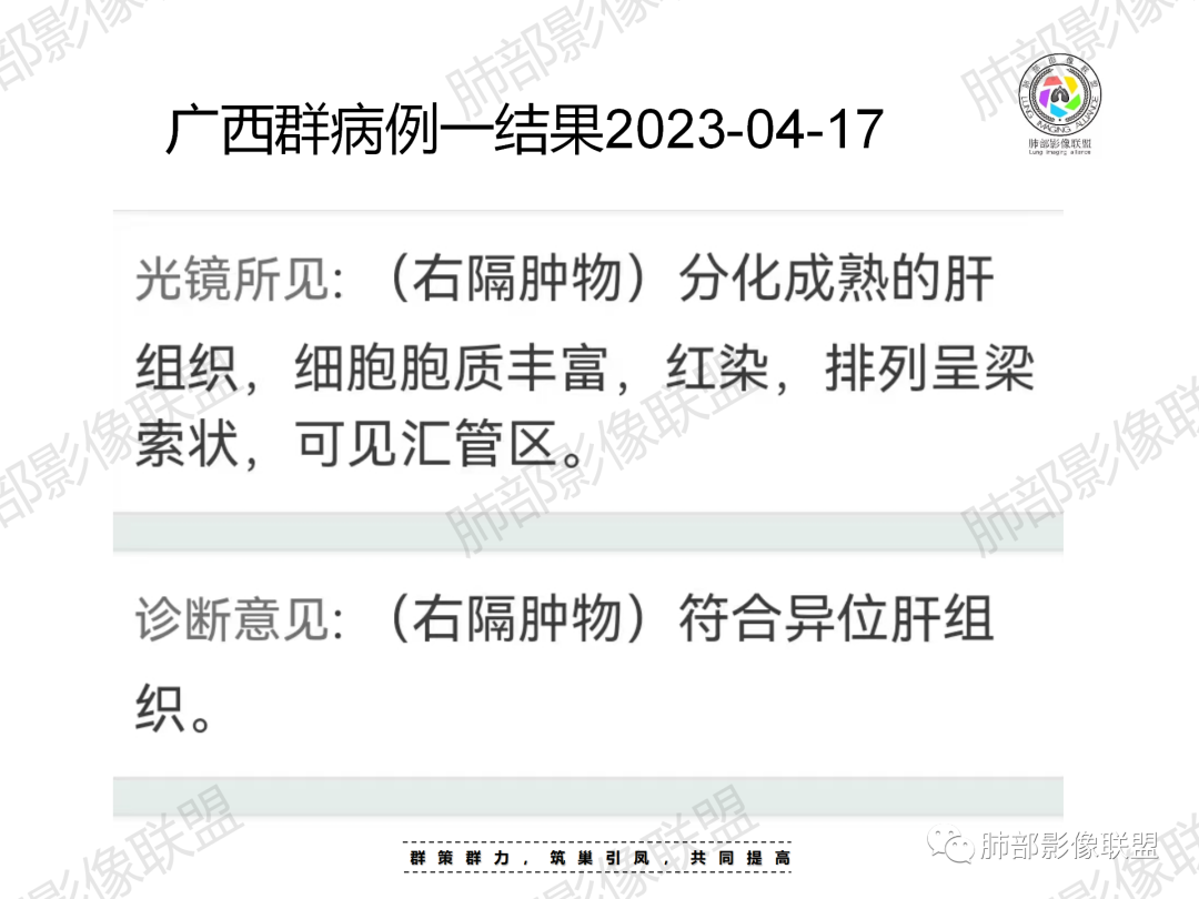 影像PPT - 【病例】胸腔内占位—异位肝1例CT影像-29 影像PPT - 【病例】胸腔内占位—异位肝1例CT影像-29