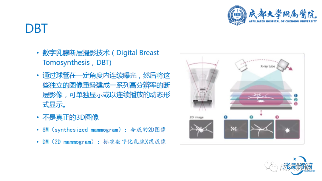 影像PPT - 【PPT】乳腺DBT初认识-5