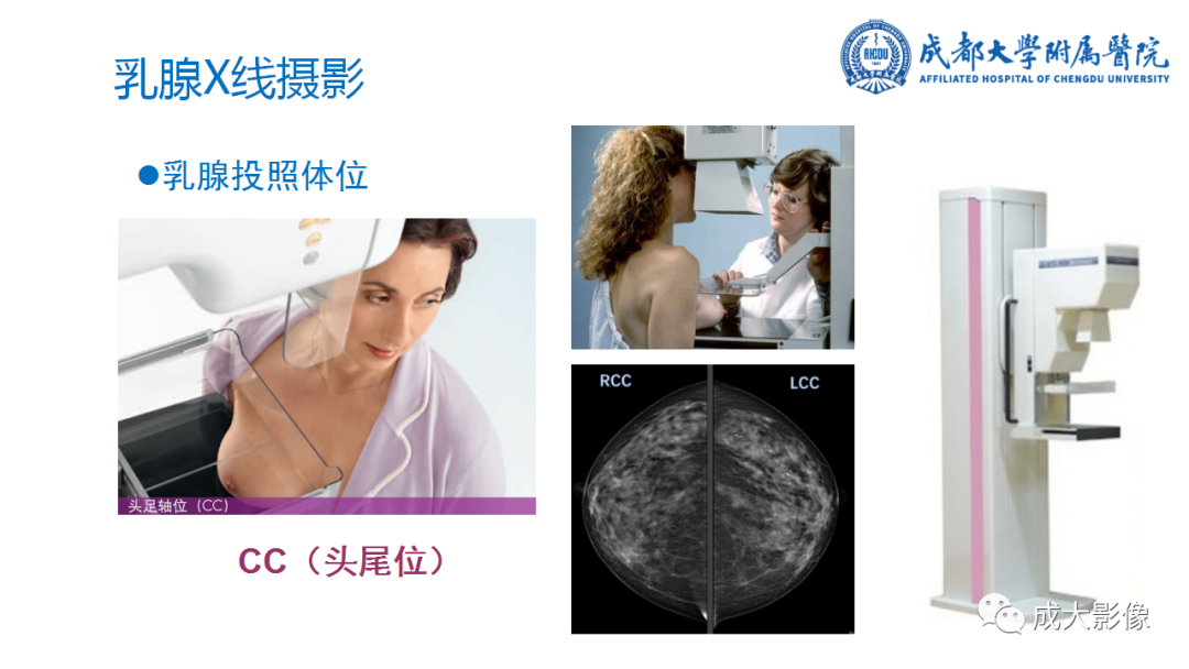 影像PPT - 【PPT】乳腺DBT初认识-7
