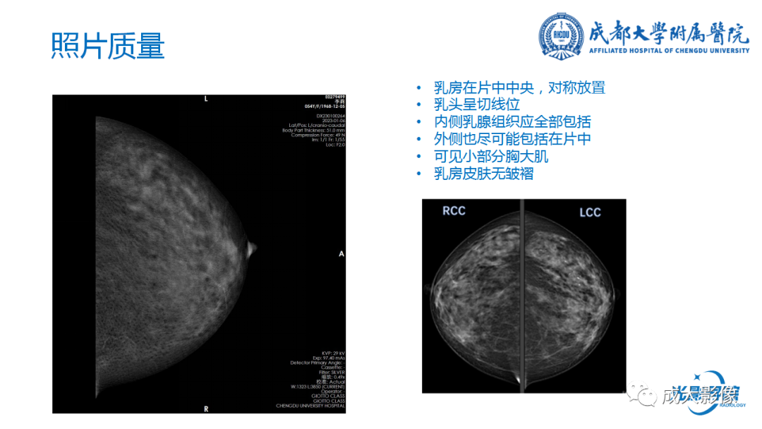 影像PPT - 【PPT】乳腺DBT初认识-8