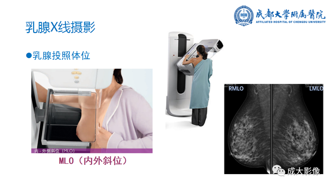 影像PPT - 【PPT】乳腺DBT初认识-9