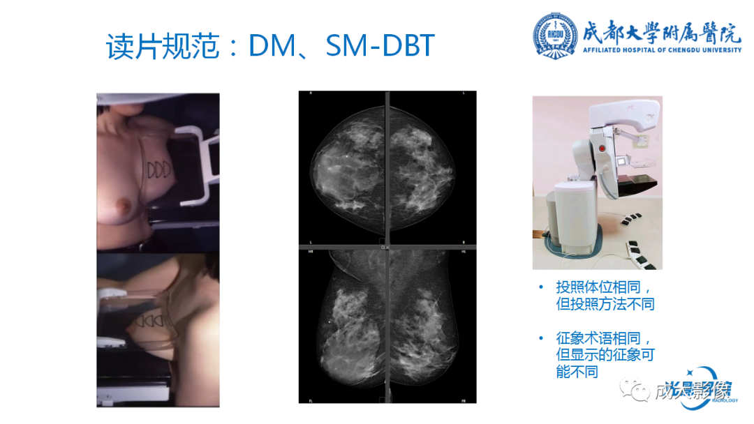 影像PPT - 【PPT】乳腺DBT初认识-11