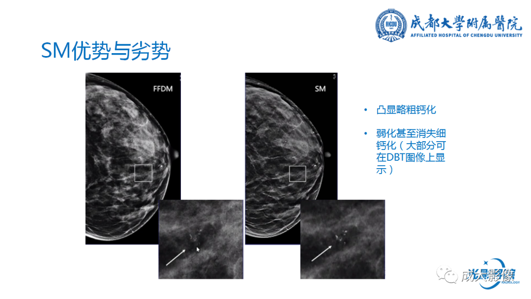 影像PPT - 【PPT】乳腺DBT初认识-26