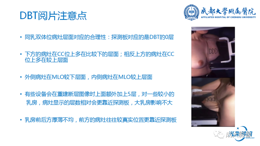 影像PPT - 【PPT】乳腺DBT初认识-33