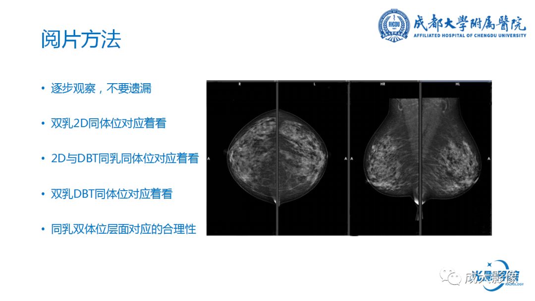 影像PPT - 【PPT】乳腺DBT初认识-34