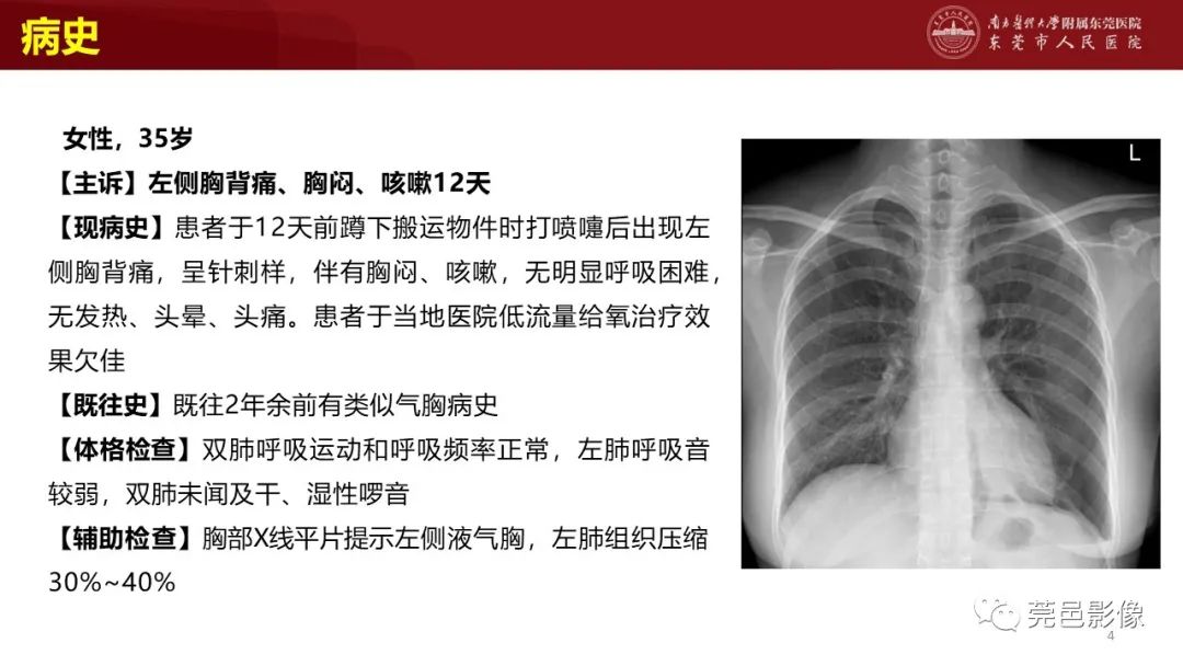 影像PPT - 【PPT】肺淋巴管肌瘤病影像诊断-2