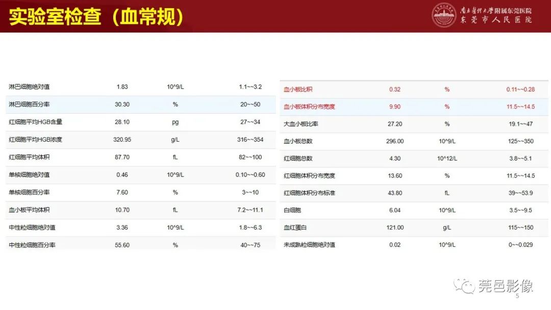 影像PPT - 【PPT】肺淋巴管肌瘤病影像诊断-3
