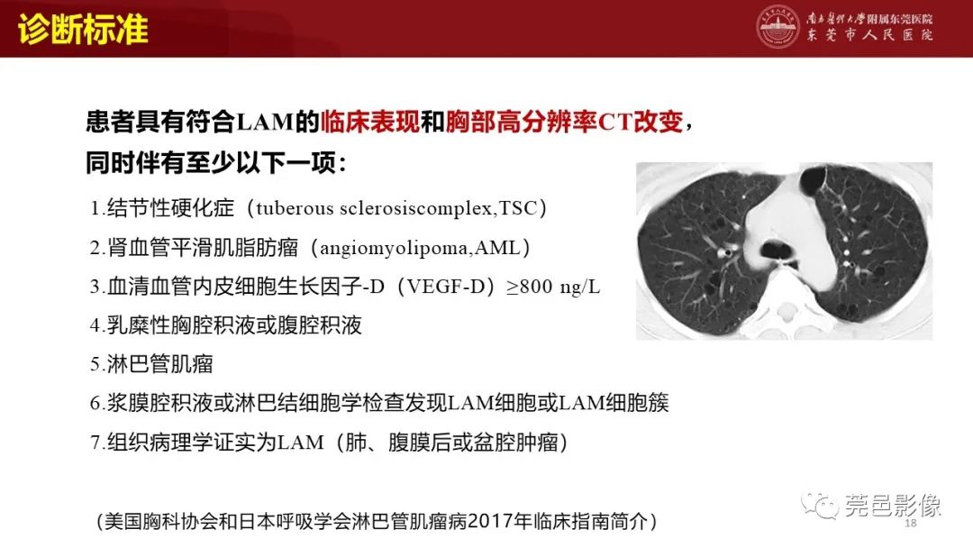影像PPT - 【PPT】肺淋巴管肌瘤病影像诊断-16