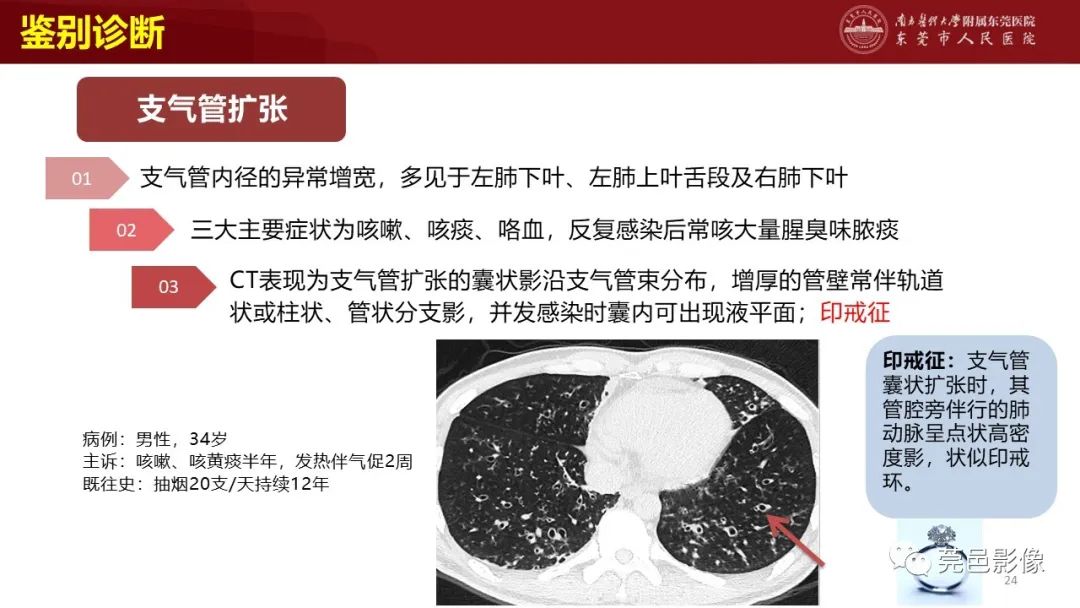 影像PPT - 【PPT】肺淋巴管肌瘤病影像诊断-22