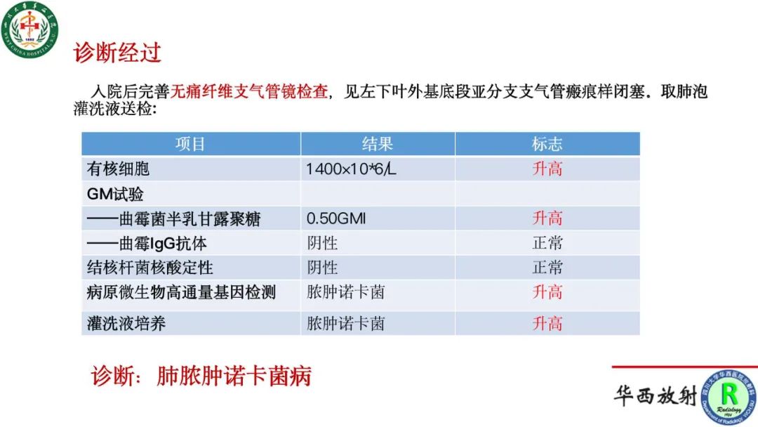 影像PPT - 【病例】肺脓肿诺卡菌病1例CT影像诊断及鉴别-7