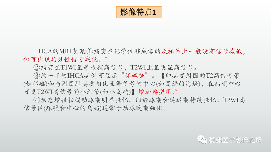 影像PPT - 【病例】肝细胞腺瘤1例CT及MR影像诊断-19