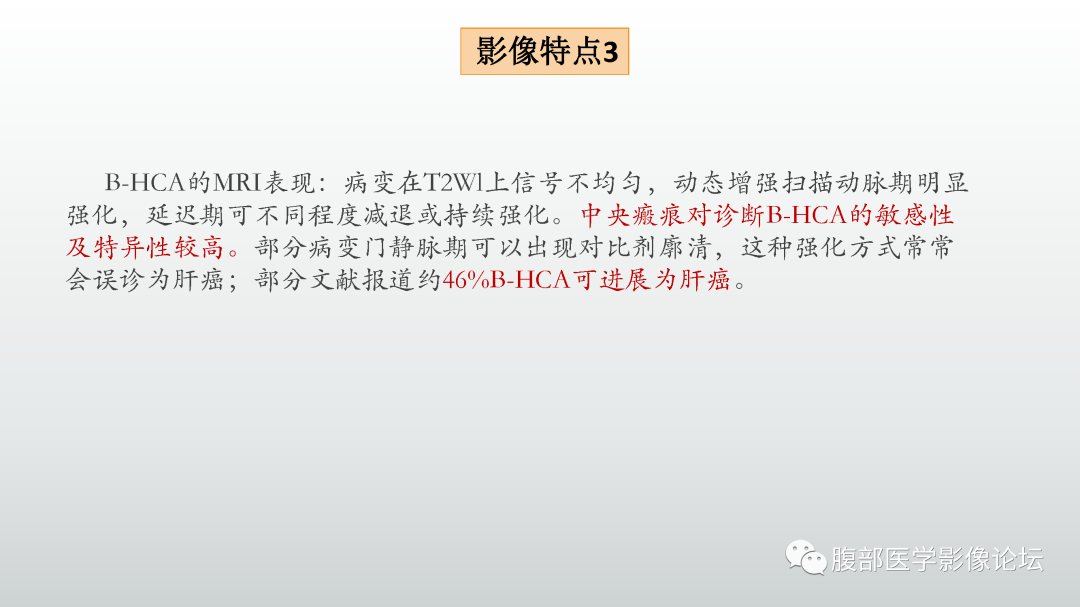 影像PPT - 【病例】肝细胞腺瘤1例CT及MR影像诊断-26