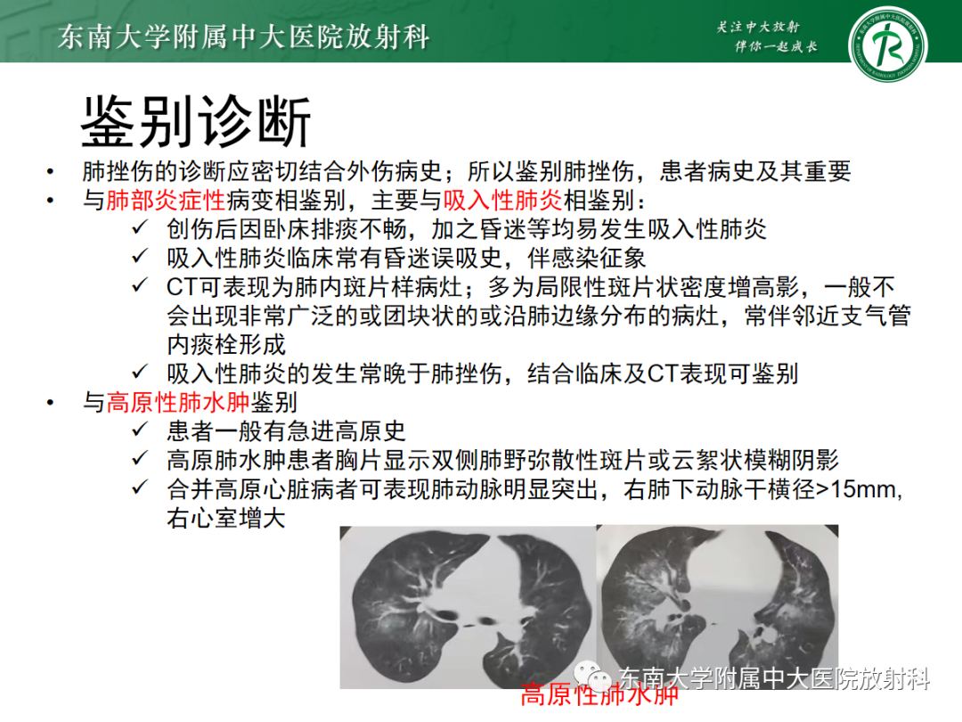 影像PPT - 【PPT】胸部外伤后的肺损伤—肺挫裂伤-22