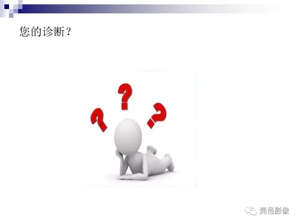 影像PPT - 【PPT】一例少见巨块外生型肝癌CT诊断及文献学习-9