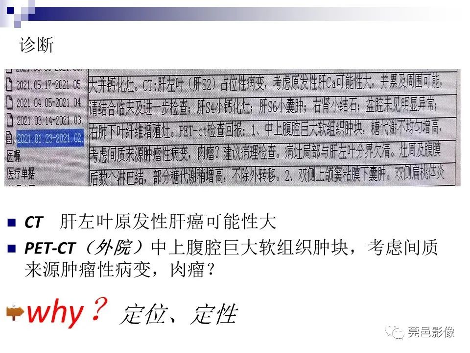 影像PPT - 【PPT】一例少见巨块外生型肝癌CT诊断及文献学习-7
