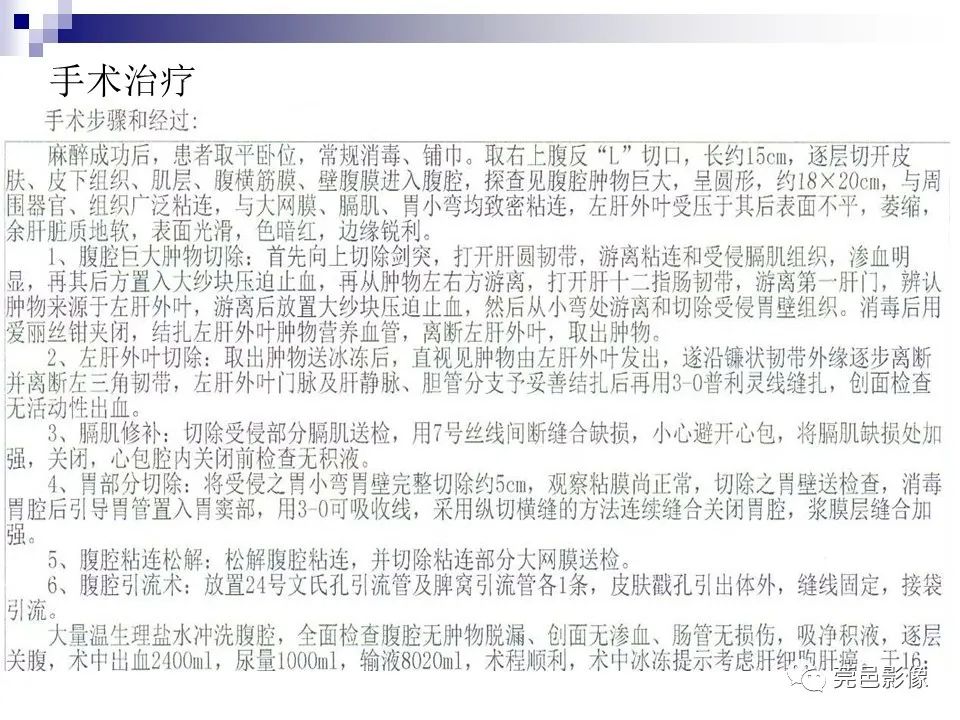 影像PPT - 【PPT】一例少见巨块外生型肝癌CT诊断及文献学习-10