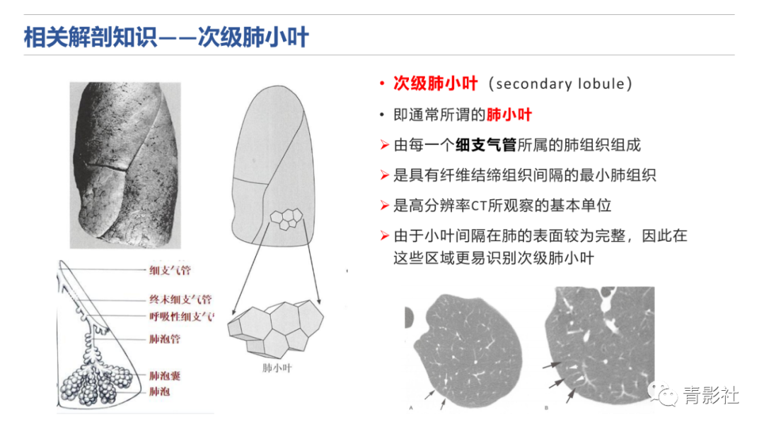 影像PPT - 【PPT】肺水肿的影像诊断-4