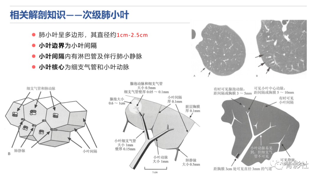 影像PPT - 【PPT】肺水肿的影像诊断-5