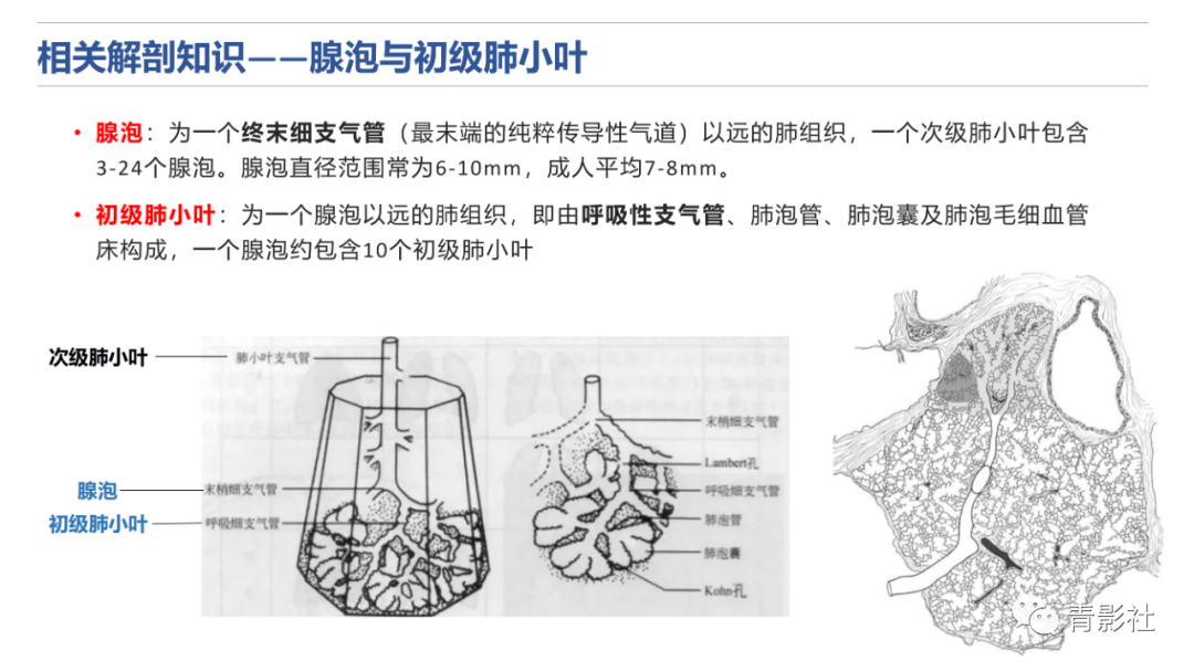 影像PPT - 【PPT】肺水肿的影像诊断-6