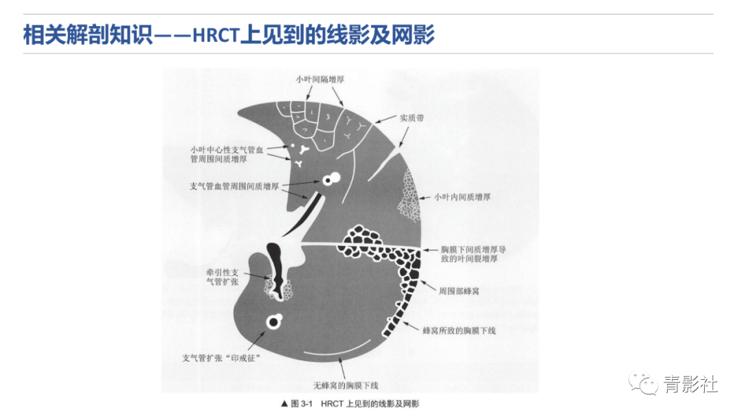 影像PPT - 【PPT】肺水肿的影像诊断-8