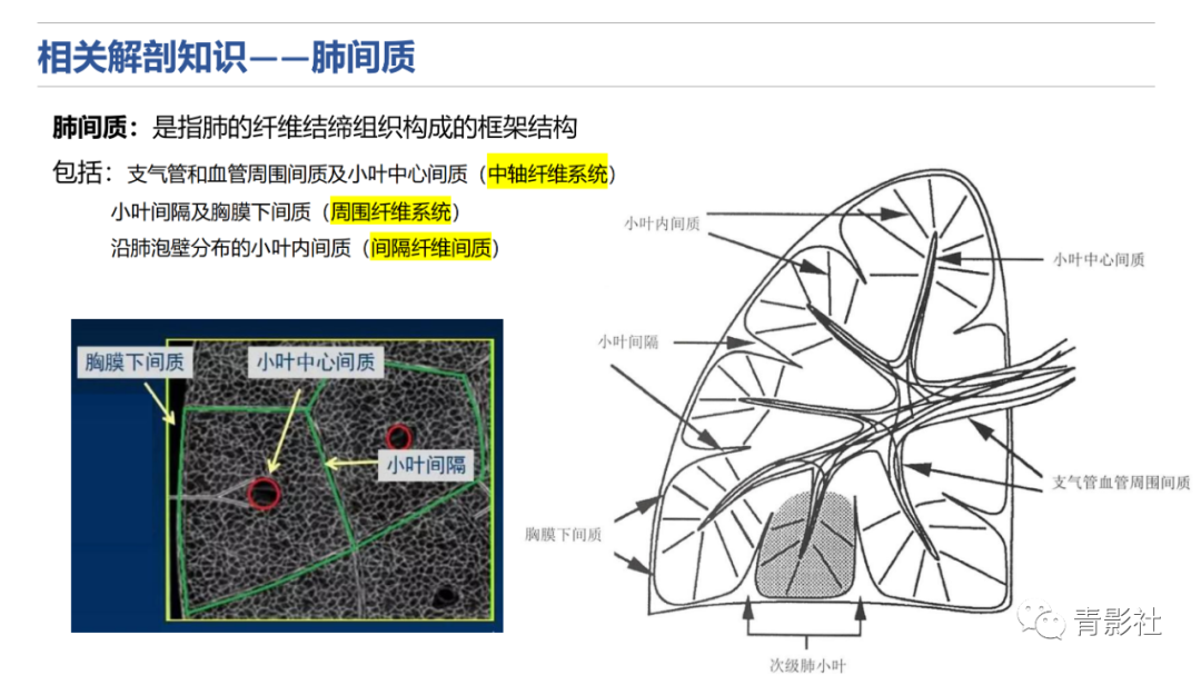 影像PPT - 【PPT】肺水肿的影像诊断-7