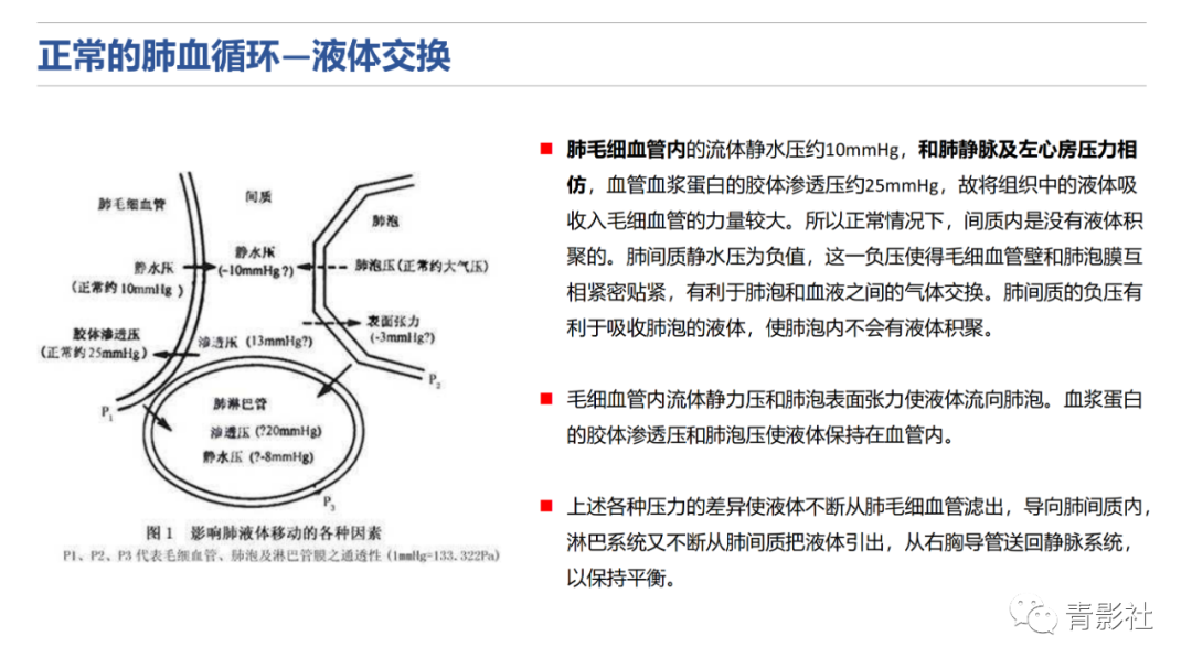 影像PPT - 【PPT】肺水肿的影像诊断-9