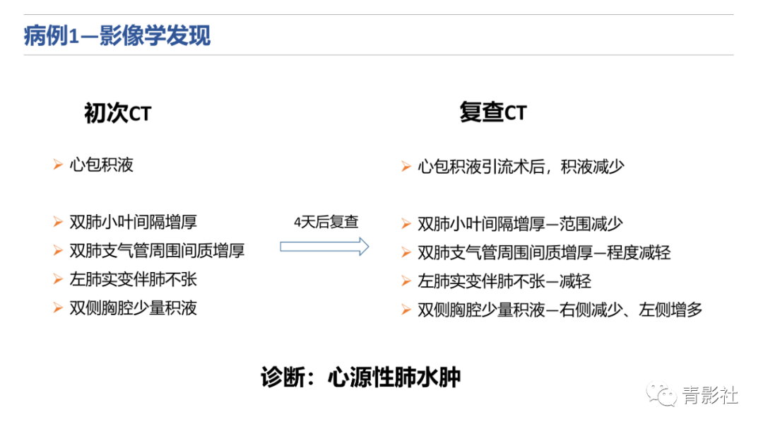 影像PPT - 【PPT】肺水肿的影像诊断-12