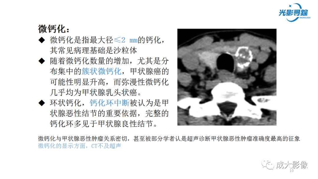 影像PPT - 【PPT】甲状腺髓样癌影像表现-5