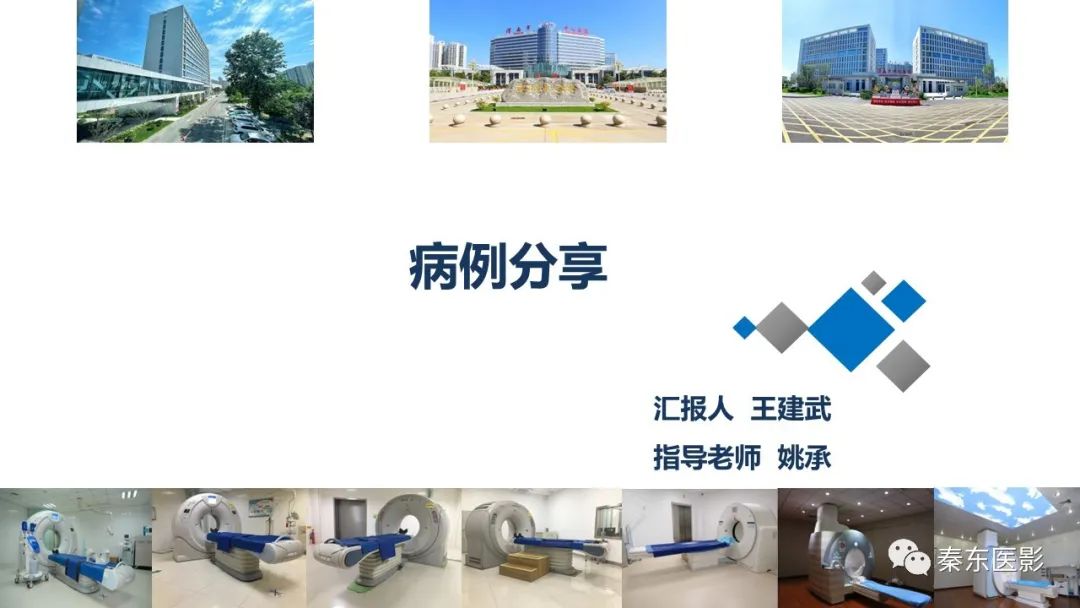 影像PPT - 【病例】面神经鞘瘤1例CT及MR影像-1