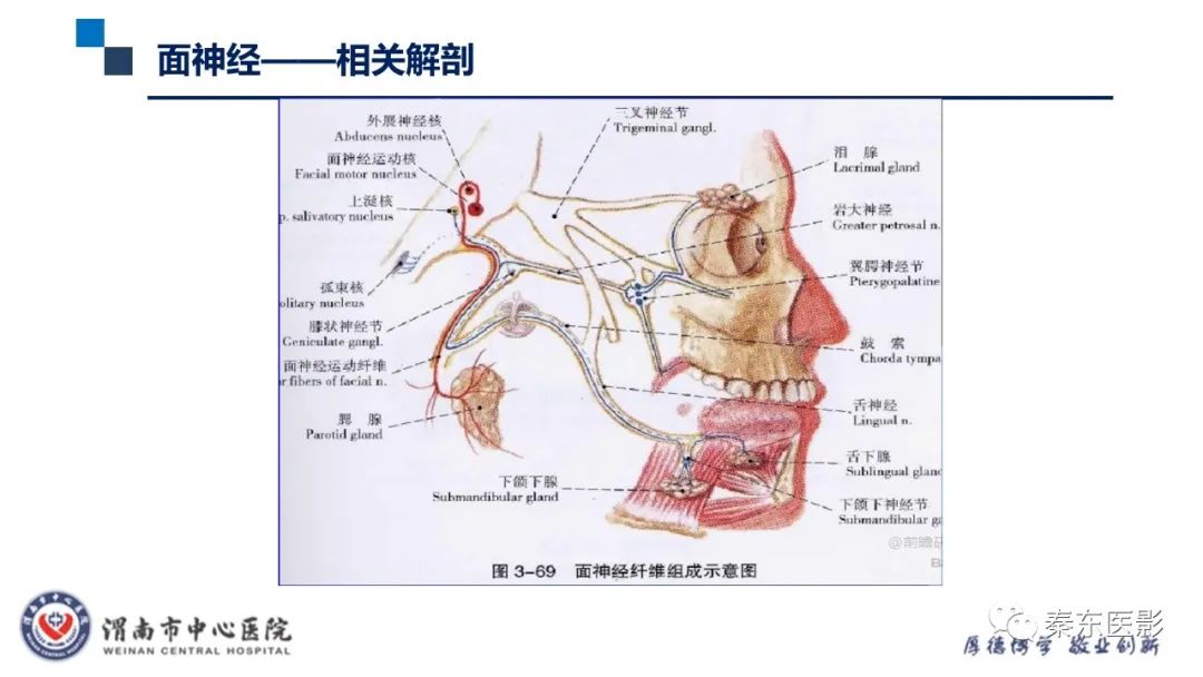 影像PPT - 【病例】面神经鞘瘤1例CT及MR影像-13