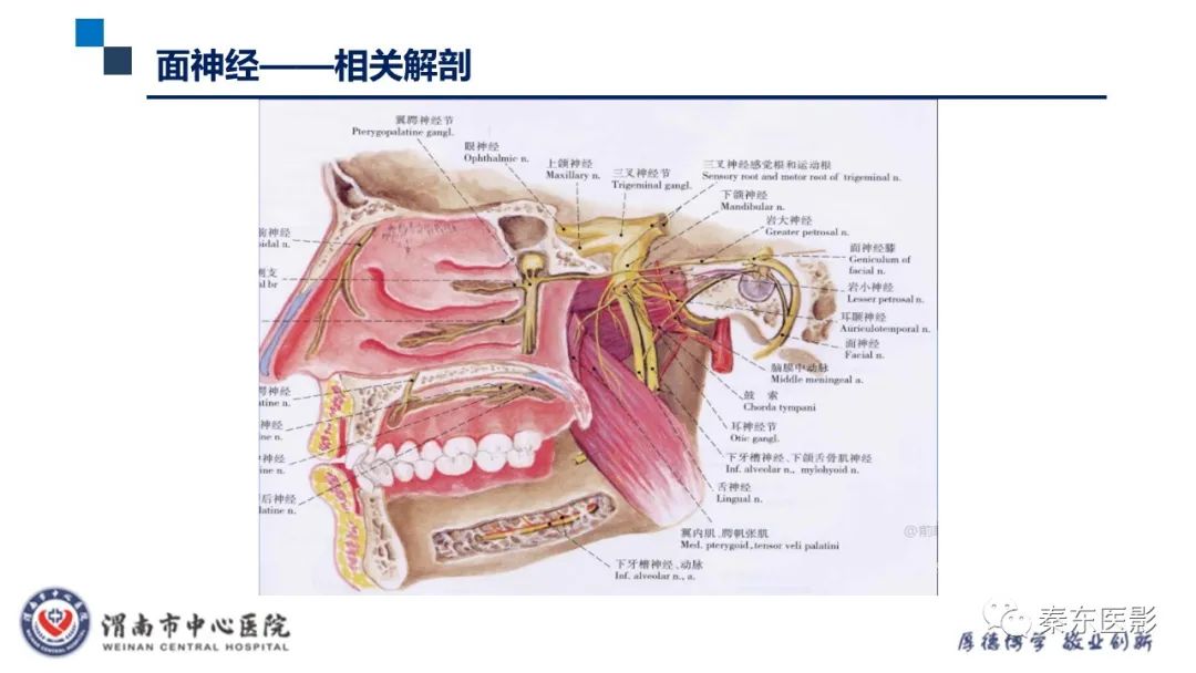 影像PPT - 【病例】面神经鞘瘤1例CT及MR影像-14