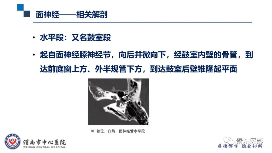 影像PPT - 【病例】面神经鞘瘤1例CT及MR影像-16