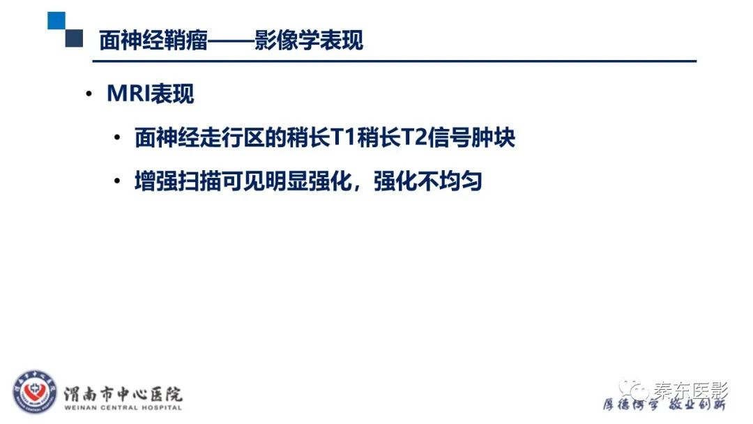 影像PPT - 【病例】面神经鞘瘤1例CT及MR影像-23