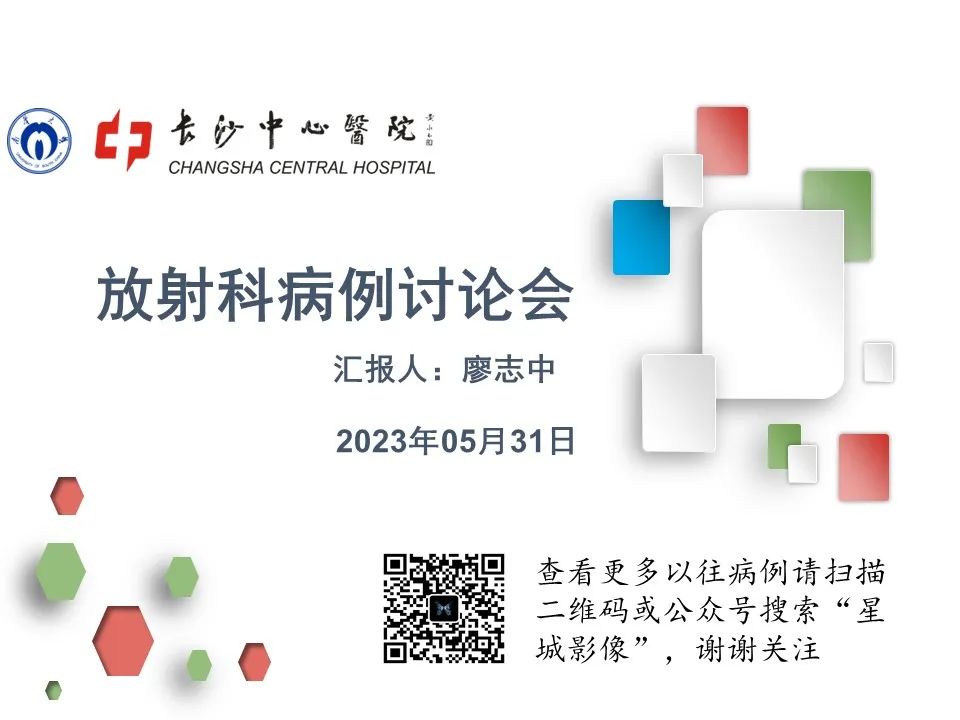 影像PPT - 【病例】壶腹周围癌1例CT影像-1 影像PPT - 【病例】壶腹周围癌1例CT影像-1