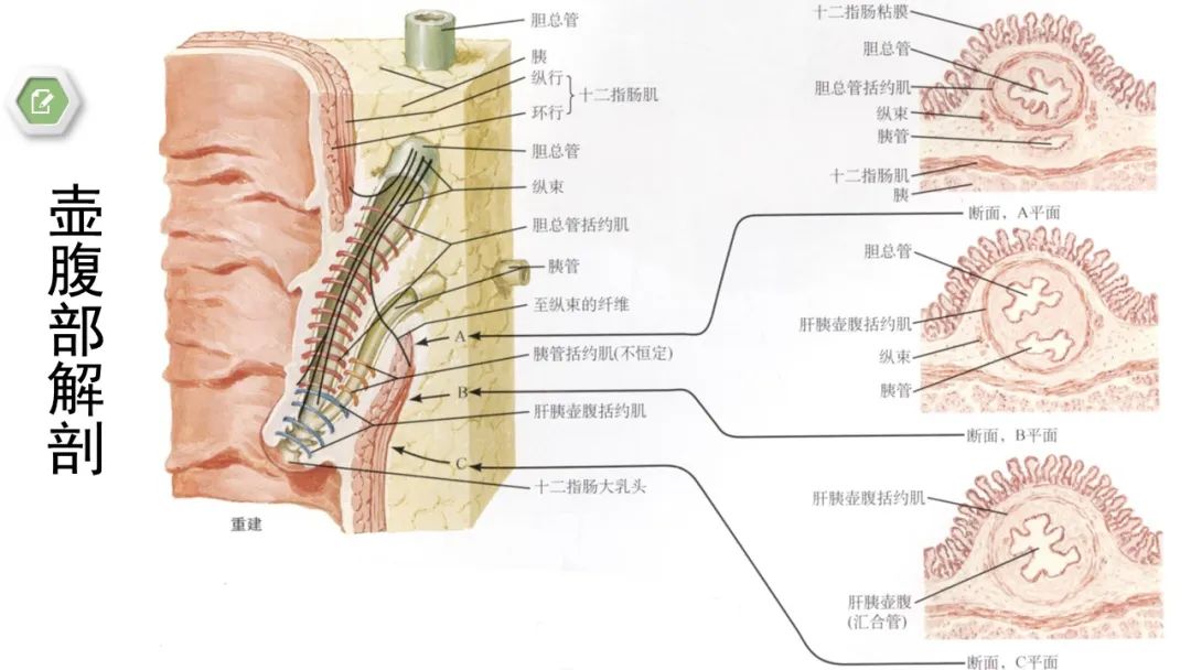 影像PPT - 【病例】壶腹周围癌1例CT影像-23 影像PPT - 【病例】壶腹周围癌1例CT影像-23