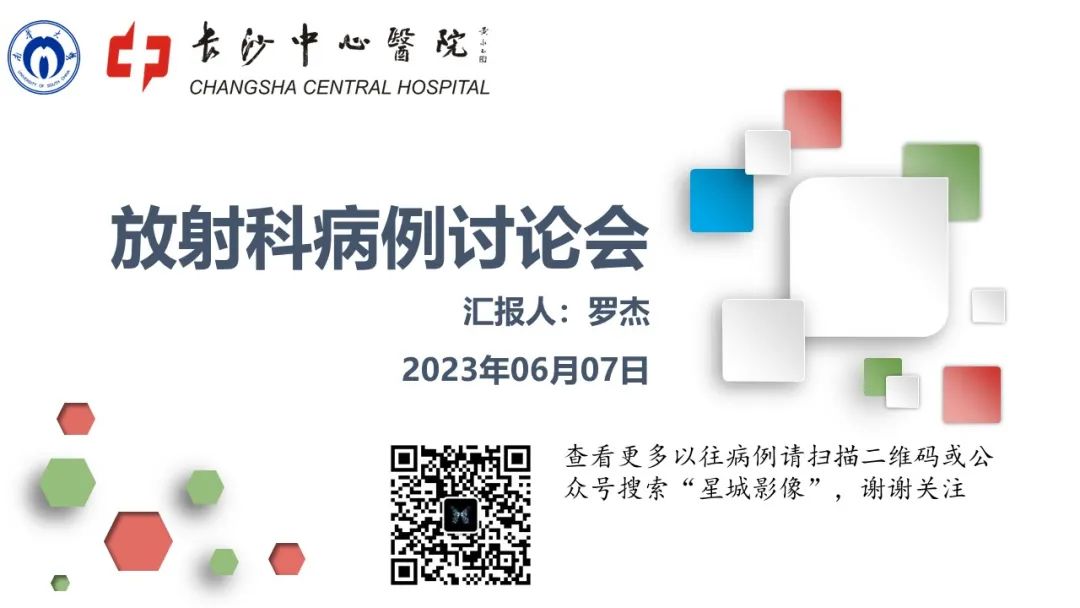 影像PPT - 【病例】肾上腺嗜铬细胞瘤1例CT影像-1 影像PPT - 【病例】肾上腺嗜铬细胞瘤1例CT影像-1