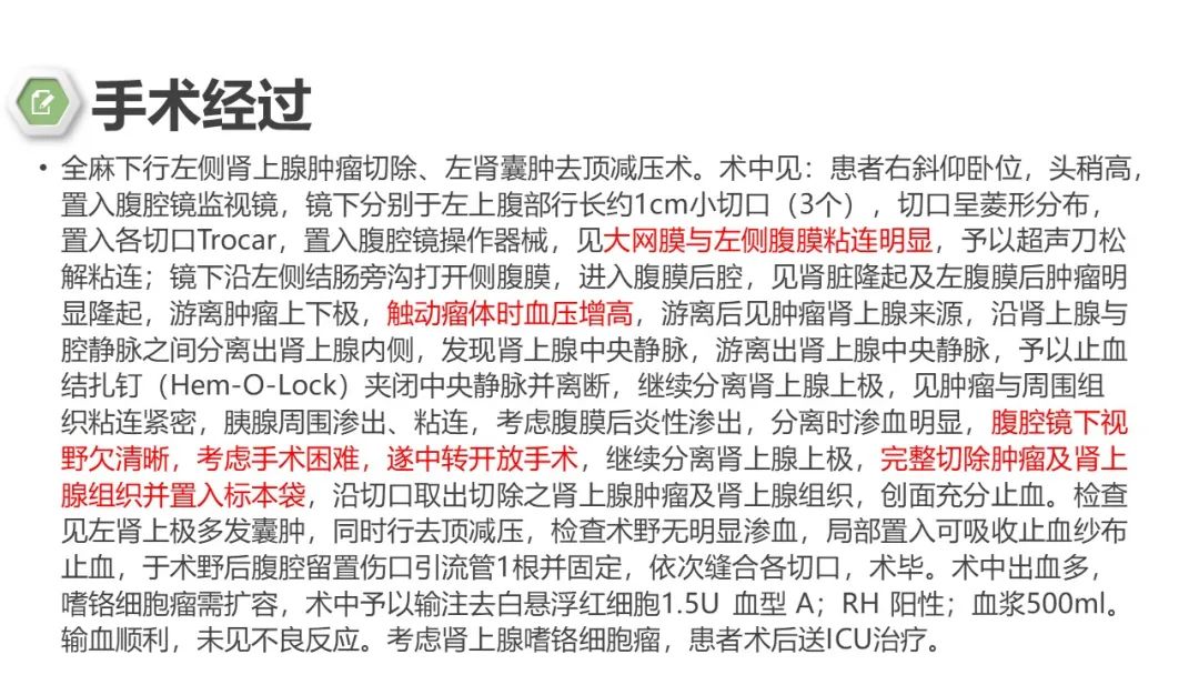 影像PPT - 【病例】肾上腺嗜铬细胞瘤1例CT影像-10 影像PPT - 【病例】肾上腺嗜铬细胞瘤1例CT影像-10
