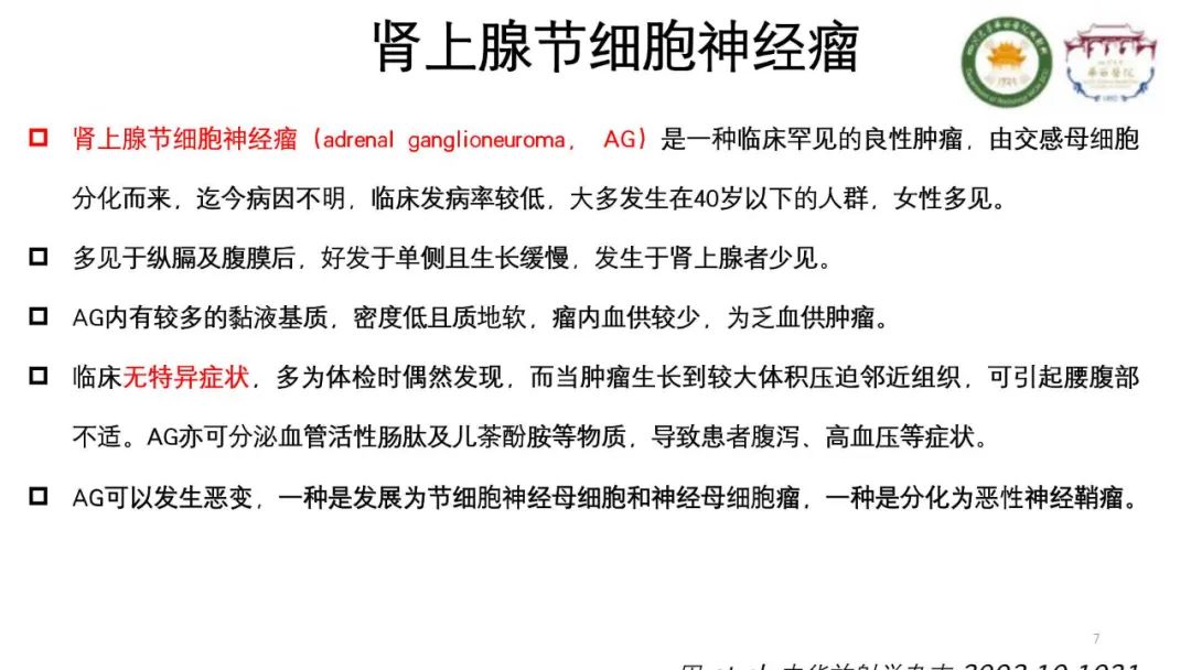 影像PPT - 【病例】腹膜后节细胞神经瘤1例CT影像-7