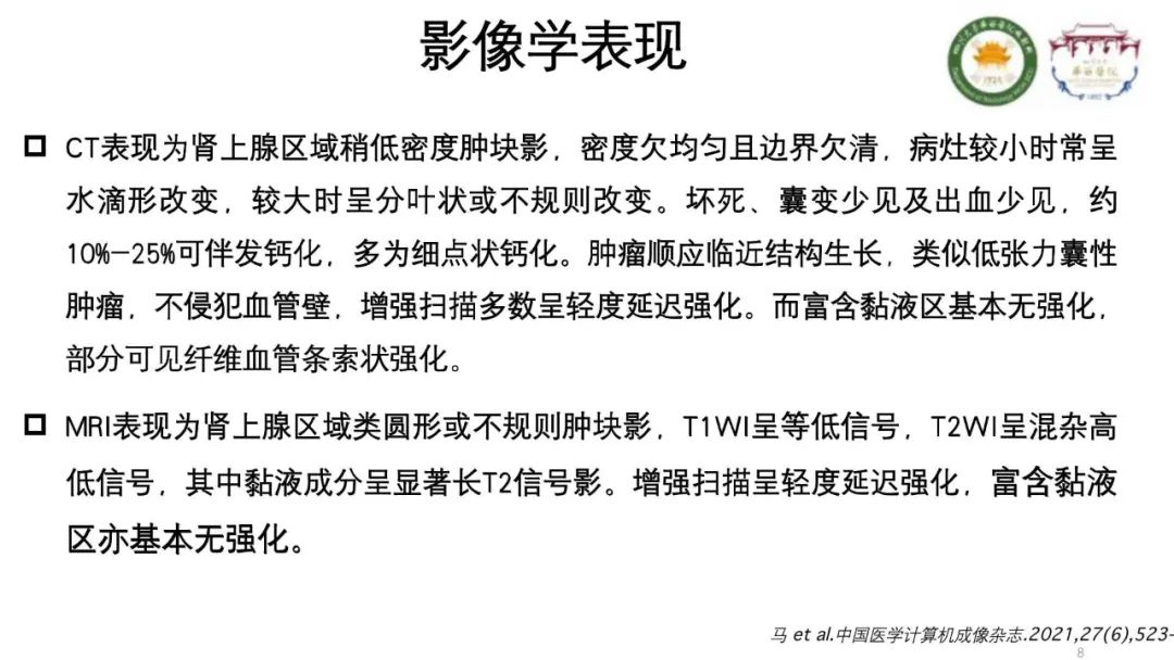 影像PPT - 【病例】腹膜后节细胞神经瘤1例CT影像-8