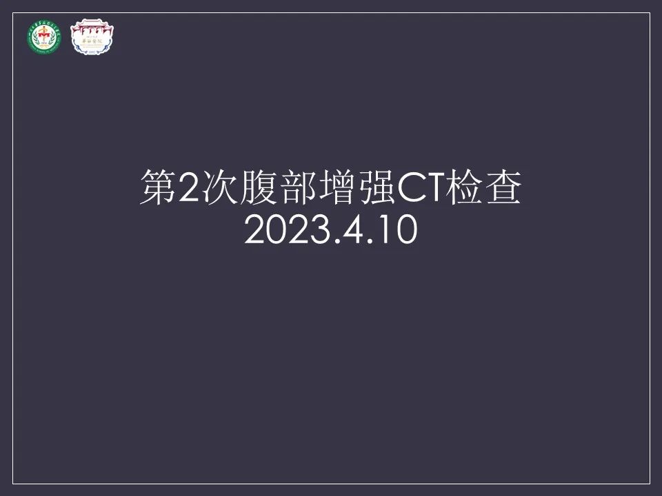 影像PPT - 【病例】肝脏念珠菌病1例CT影像-5