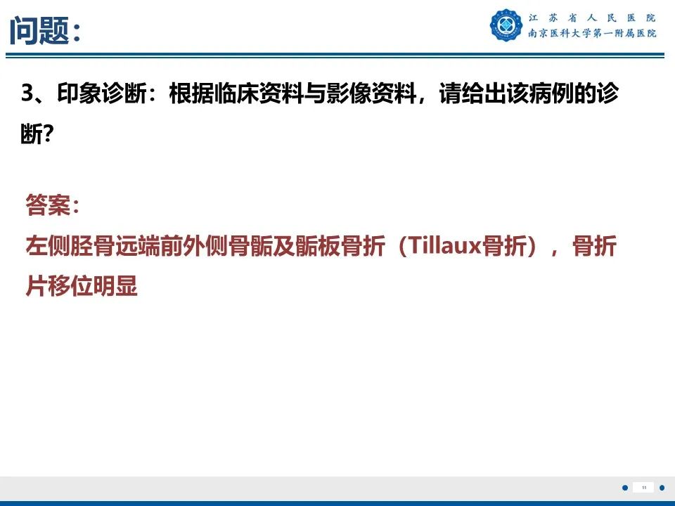 影像PPT - 【PPT】Tillaux骨折-12